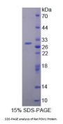 Rat Pericentriolar Material 1 (PCM1) Protein