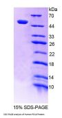 Human Polymerase DNA Directed Delta 1 (POLd) Protein