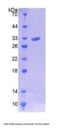 Human Twinkle Protein, Mitochondrial (TWINL) Protein