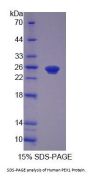 Human Peroxisomal Biogenesis Factor 1 (PEX1) Protein