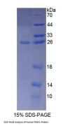 Human Phosphoglucomutase 1 (PGM1) Protein