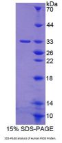 Human Protein Kinase D3 (PKD3) Protein