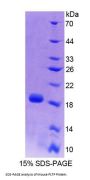 Mouse Phospholipid Transfer Protein (PLTP) Protein