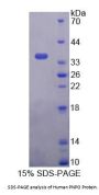 Human Pyridoxamine-5'-Phosphate Oxidase (PNPO) Protein
