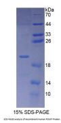 Human Proteasome Maturation Protein (POMP) Protein
