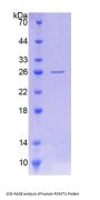 Human Protein O-Mannosyltransferase 1 (POMT1) Protein