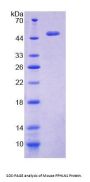 Mouse Periphilin 1 (PPHLN1) Protein