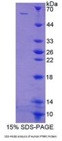 Human Polypyrimidine Tract Binding Protein 1 (PTBP1) Protein