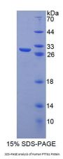 Human Pituitary Tumor Transforming 1 (PTTG1) Protein