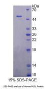 Human Pseudouridylate Synthase 1 (PUS1) Protein