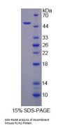 Mouse Perilipin 1 (PLIN1) Protein