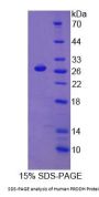 Human Proline Dehydrogenase, Mitochondrial (PRODH) Protein