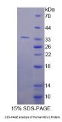 Human Ras Suppressor Protein 1 (RSU1) Protein