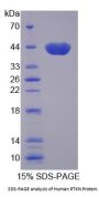 Human Rhotekin (RTKN) Protein