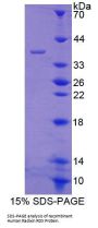 Human Radixin (RDX) Protein