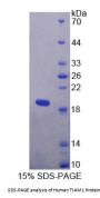 Human T-Cell Lymphoma Invasion And Metastasis Inducing Protein 1 (TIAM1) Protein