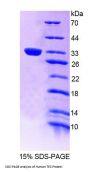 Human Tec Protein Tyrosine Kinase (TEC) Protein