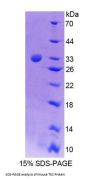 Mouse Tec Protein Tyrosine Kinase (TEC) Protein