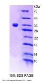 Human Testis Specific Kinase 1 (TESK1) Protein