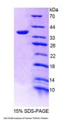 Human Transmembrane Protein 1 (TMEM1) Protein