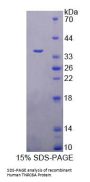 Human Trinucleotide Repeat Containing Protein 6A (TNRC6A) Protein