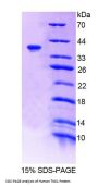 Human Tensin 1 (TNS1) Protein