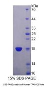 Human Trafficking Protein Particle Complex 2 (TRAPPC2) Protein