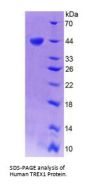 Human Three Prime Repair Exonuclease 1 (TREX1) Protein
