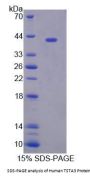 Human GDP-L-Fucose Synthetase (GFUS) Protein