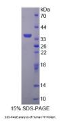 Human Thromboxane Receptor (TP) Protein