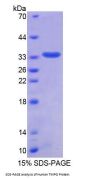 Human Thymopoietin (TMPO) Protein