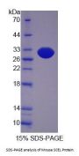 Mouse Sciellin (SCEL) Protein