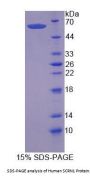 Human Secernin 1 (SCRN1) Protein