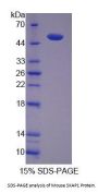 Mouse Src Kinase Associated Phosphoprotein 1 (SKAP1) Protein