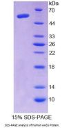 Human Aminoadipate Semialdehyde Synthase (AASS) Protein