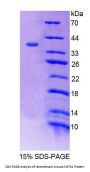 Mouse Syntrophin Beta 1 (SNTb1) Protein