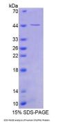 Human Snurportin 1 (SNUPN1) Protein