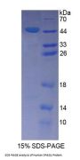 Human Sperm Associated Antigen 1 (SPAG1) Protein