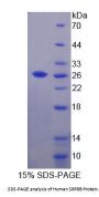 Human Signal Recognition Particle Receptor B (SRPRB) Protein