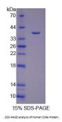 Human Signal Sequence Receptor Alpha (SSRa) Protein