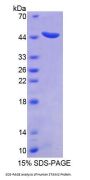 Human Signal Transducing Adaptor Molecule 2 (STAM2) Protein