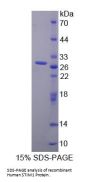 Human Stromal Interaction Molecule 1 (STIM1) Protein