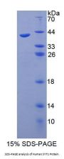 Human Synaptotagmin I (SYT1) Protein