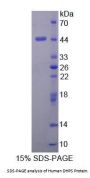 Human Deoxyhypusine Synthase (DHPS) Protein