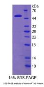 Human Reticulon 1 (RTN1) Protein