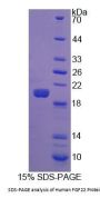 Human Fibroblast Growth Factor 22 (FGF22) Protein