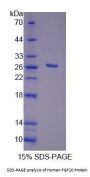 Human Fibroblast Growth Factor 20 (FGF20) Protein