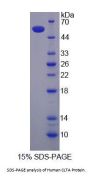 Human Clathrin, Light Polypeptide A (CLTA) Protein