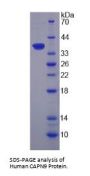 Human Calpain 9 (CAPN9) Protein
