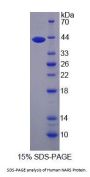 Human Asparaginyl tRNA Synthetase (NARS) Protein
